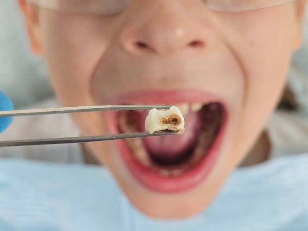 Best After-Hours Dental Trauma Care in Fairfield, CA